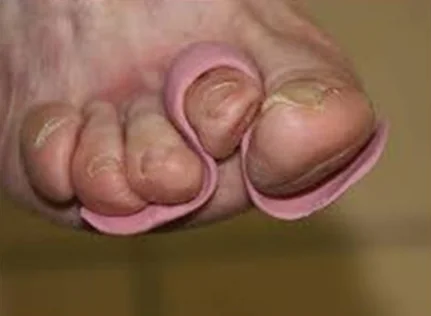 Zigzag orthese